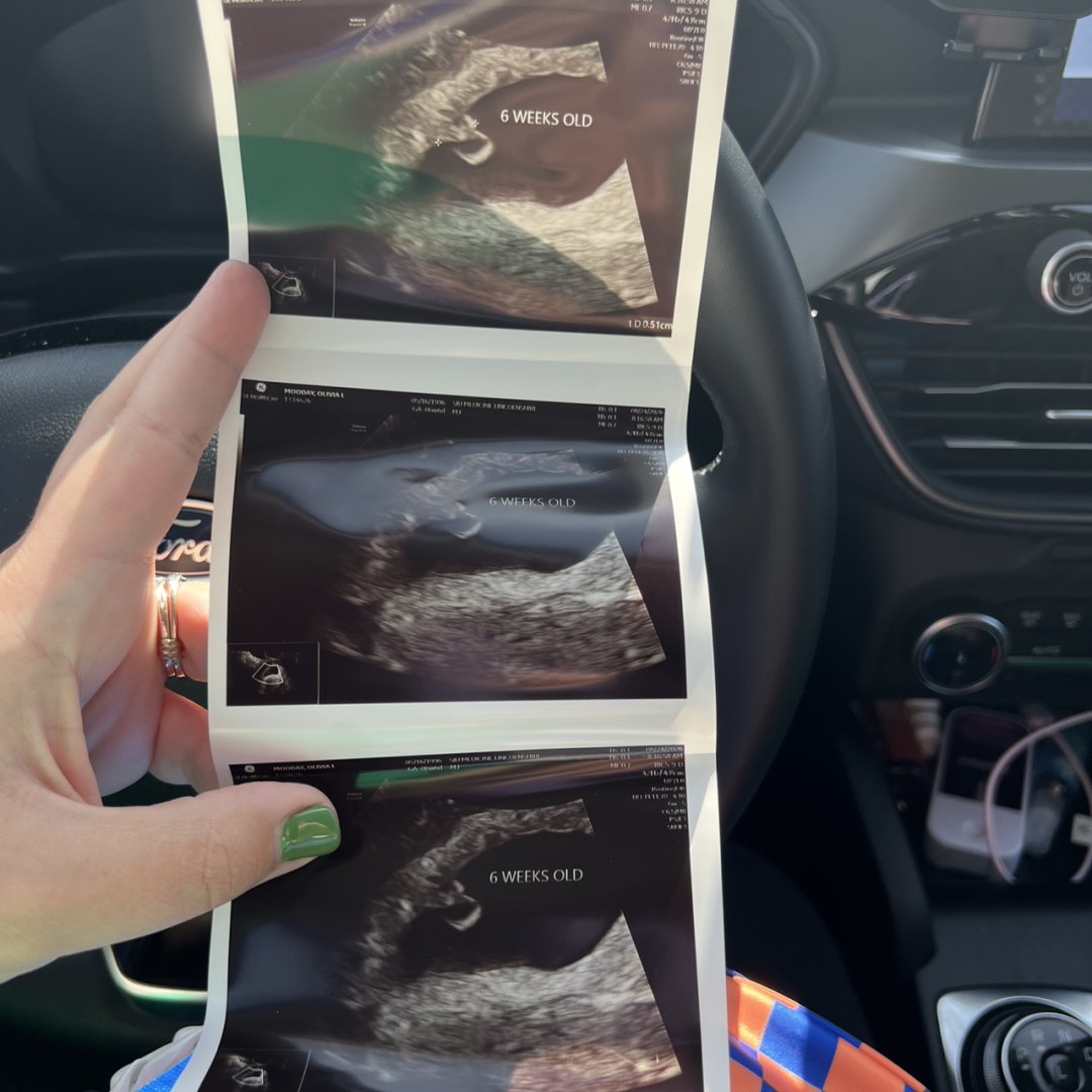 Photo shared by Olivia for their Babylist baby registry.