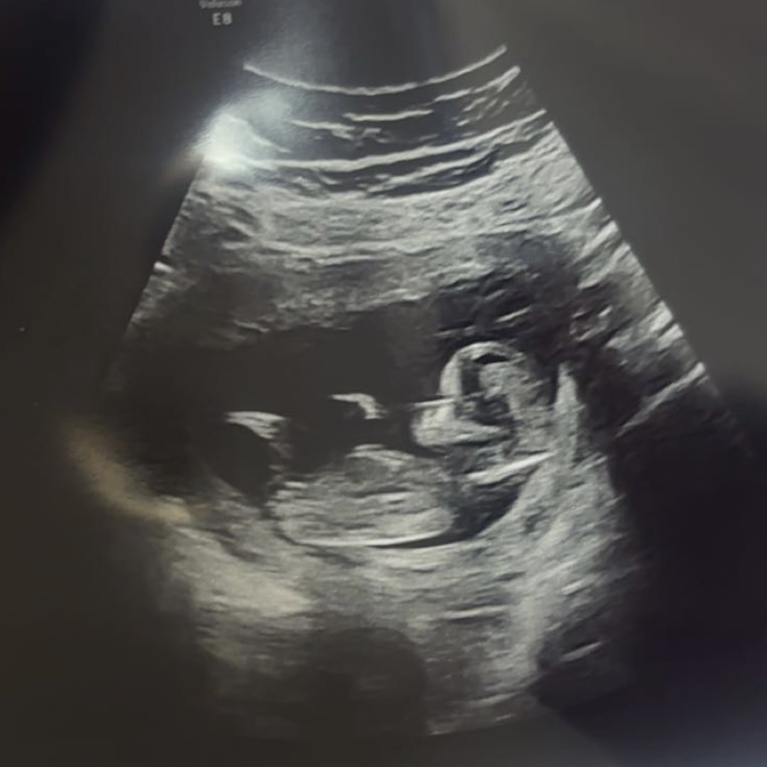 Photo shared by Annie for their Babylist baby registry.