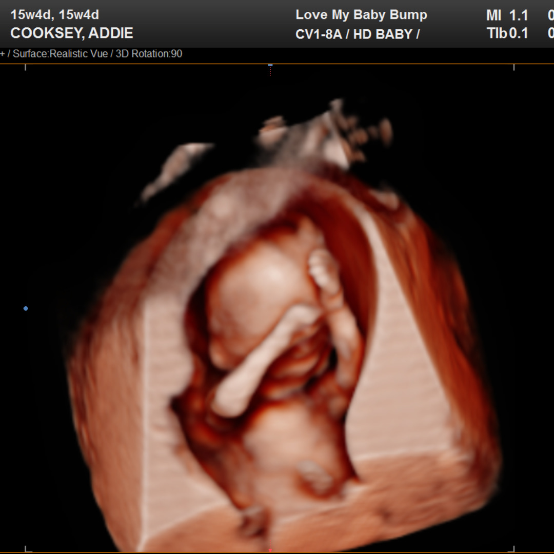 Photo shared by Addie for their Babylist baby registry.