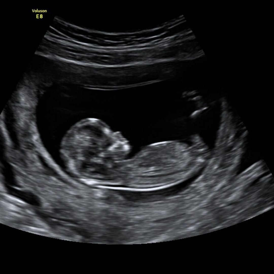 Photo shared by Hillary for their Babylist baby registry.