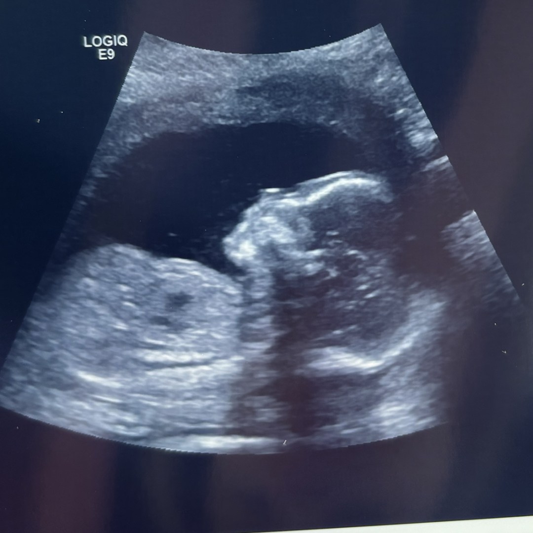 Photo shared by Ellie for their Babylist baby registry.