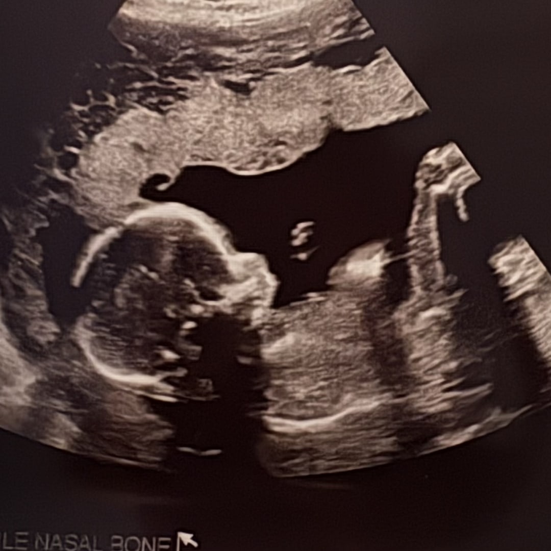 Photo shared by Alexis for their Babylist baby registry.