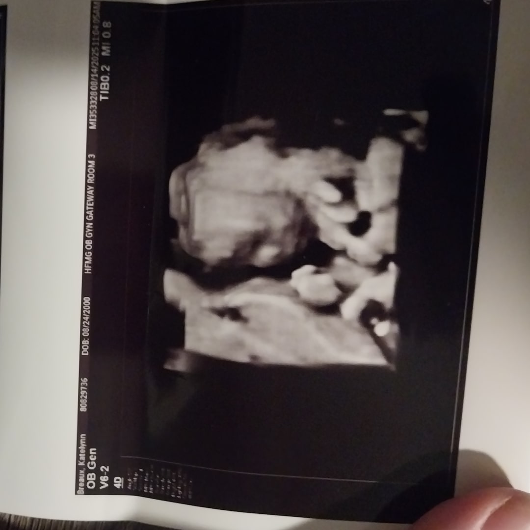 Photo shared by Katelynn for their Babylist baby registry.