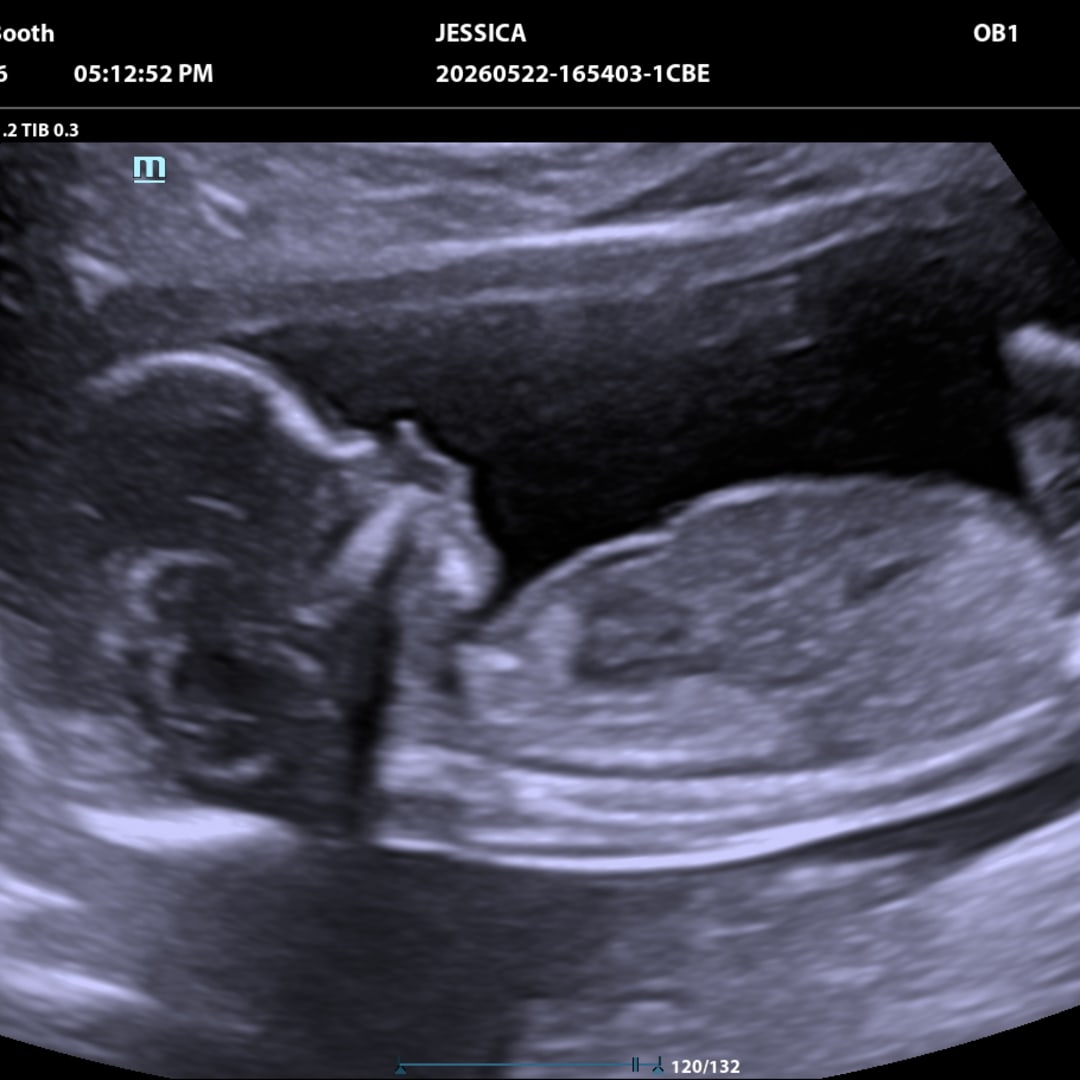 Photo shared by Jessica for their Babylist baby registry.