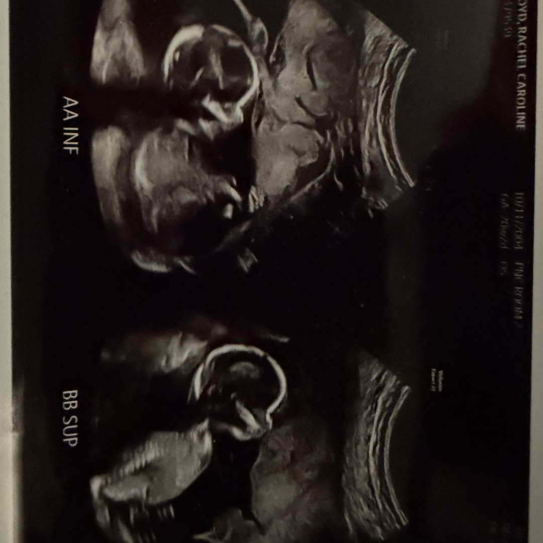Photo shared by Rachel for their Babylist baby registry.