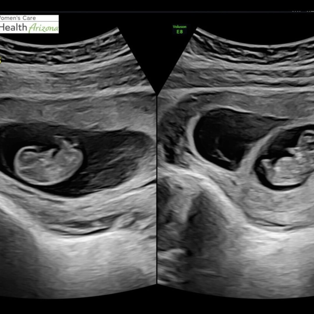 Photo shared by Braden for their Babylist baby registry.
