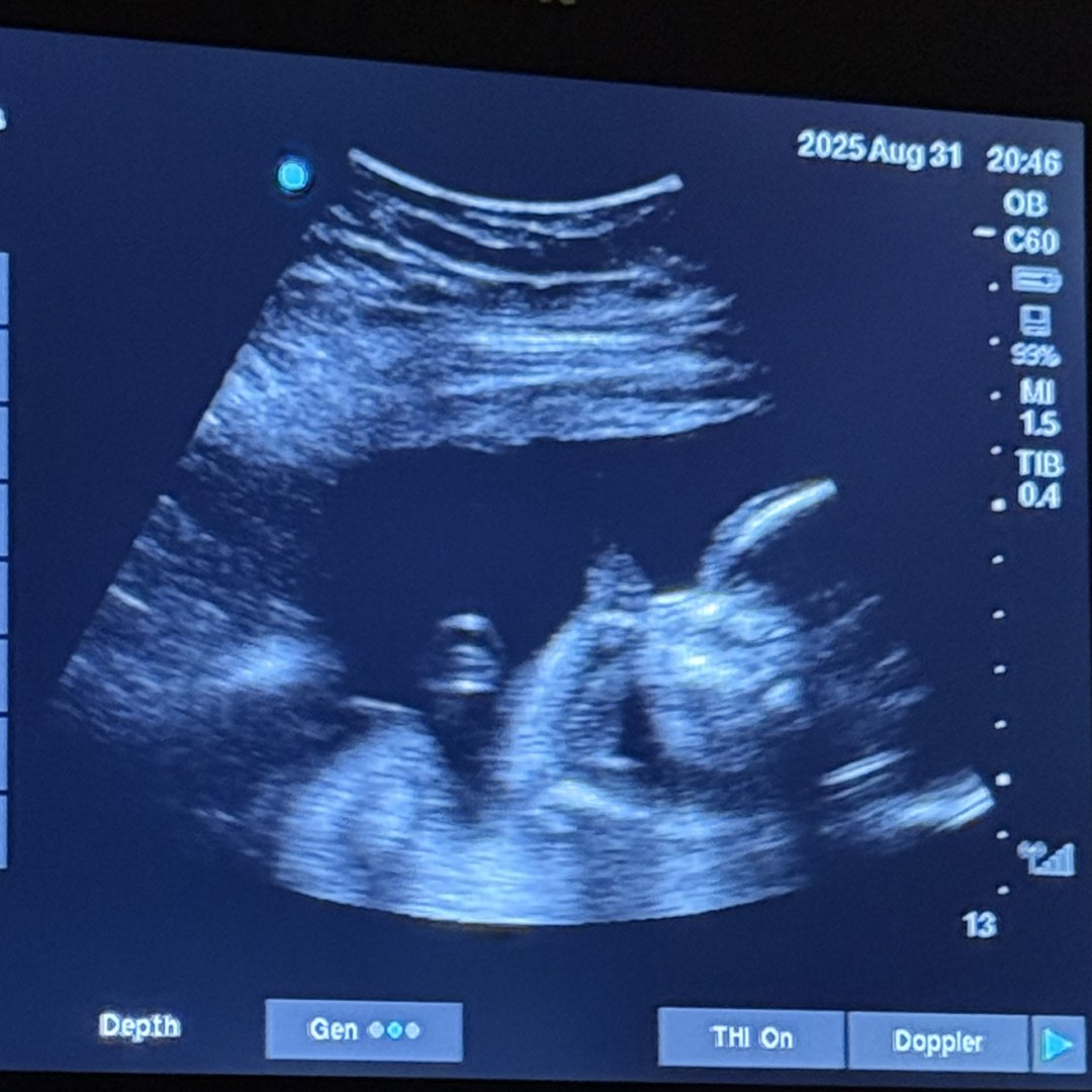 Photo shared by Jaidyn for their Babylist baby registry.