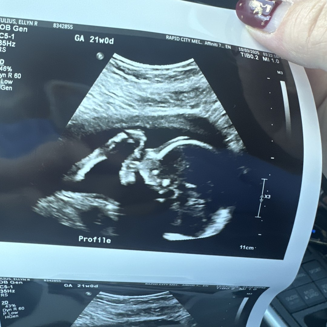 Photo shared by Ellyn for their Babylist baby registry.