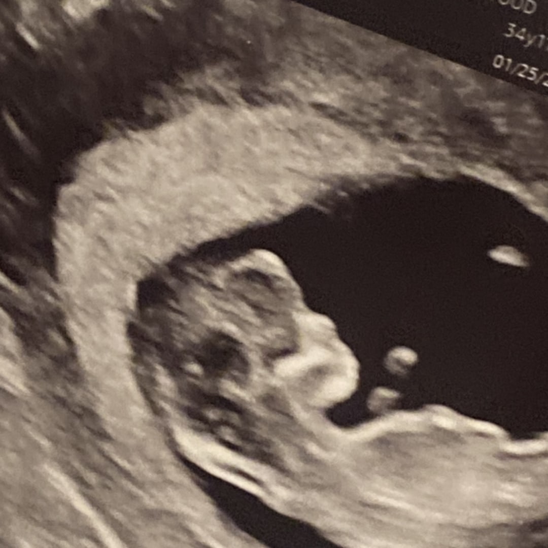 Photo shared by Courtney for their Babylist baby registry.