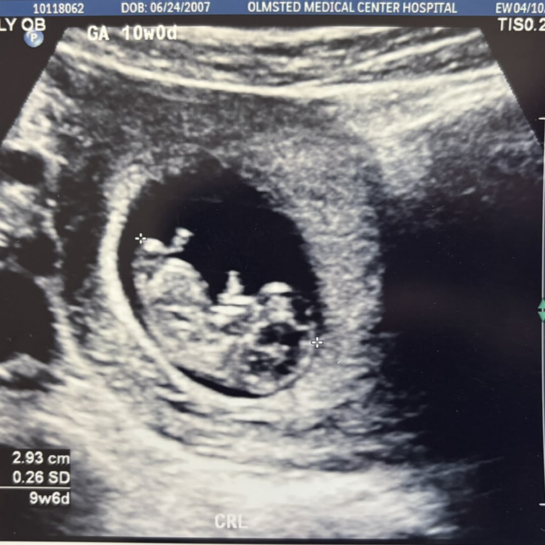 Photo shared by Jayda for their Babylist baby registry.