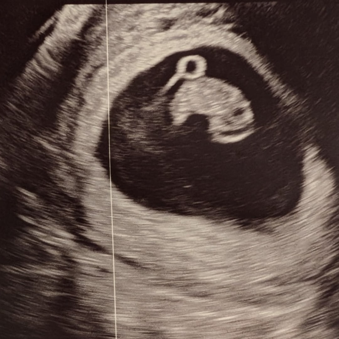 Photo shared by Sami for their Babylist baby registry.