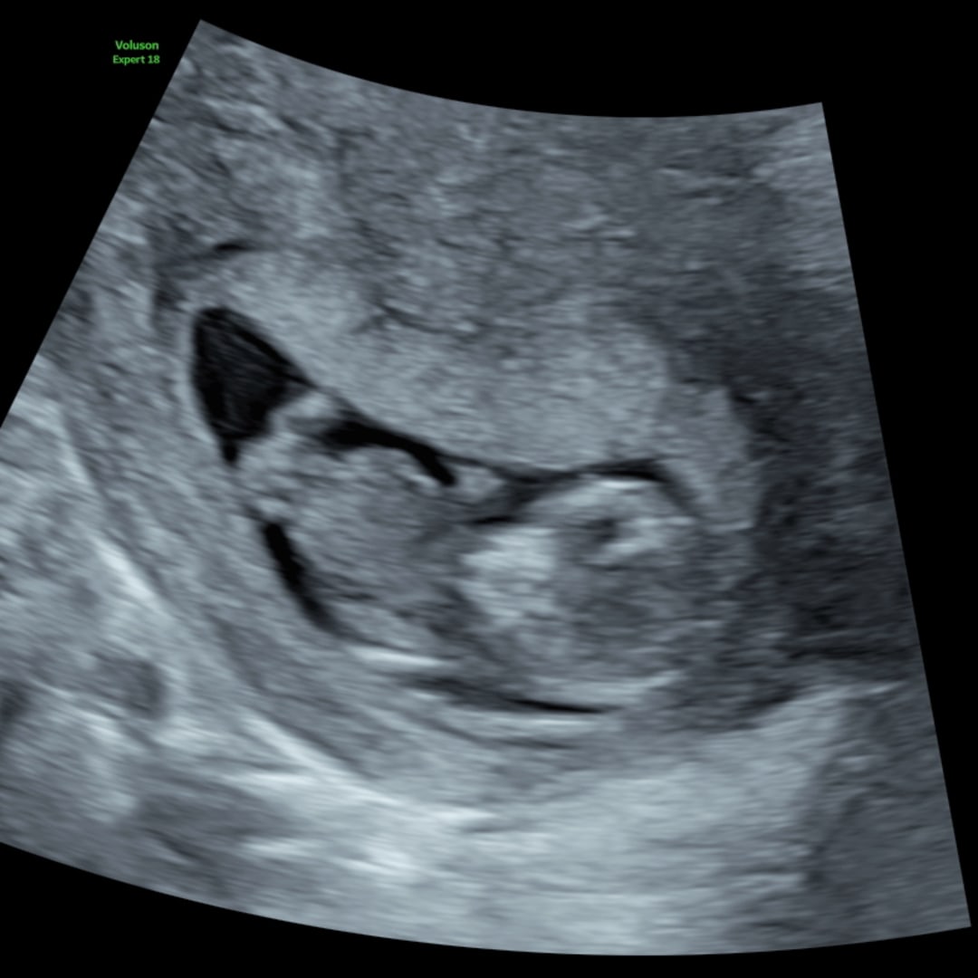 Photo shared by Brianna for their Babylist baby registry.