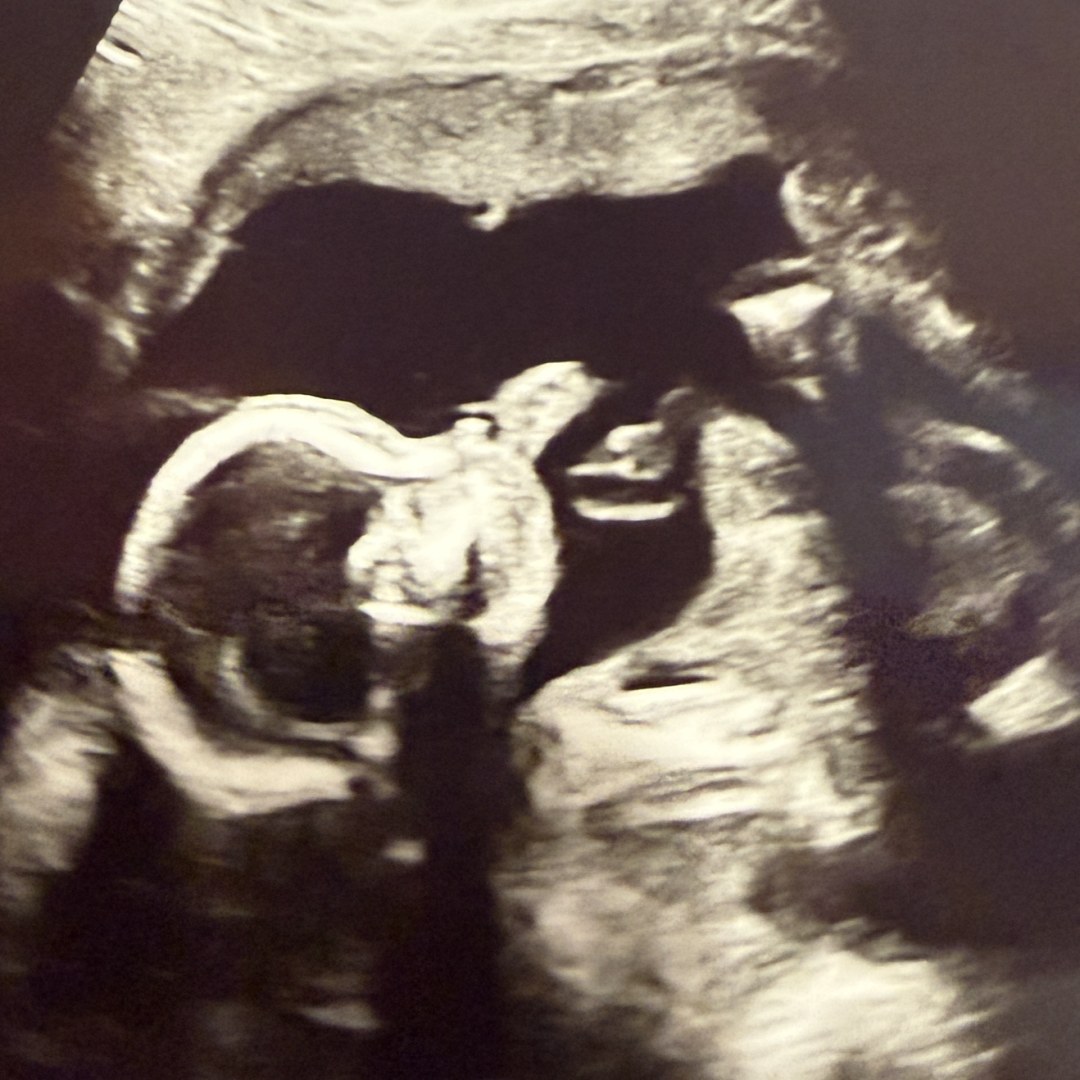Photo shared by Tabitha for their Babylist baby registry.