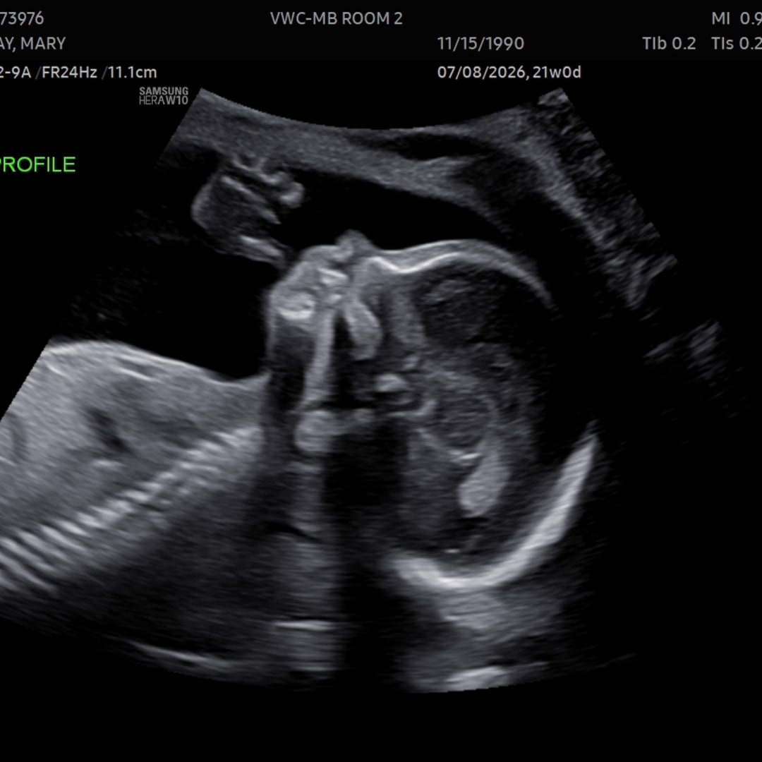Photo shared by Mary for their Babylist baby registry.