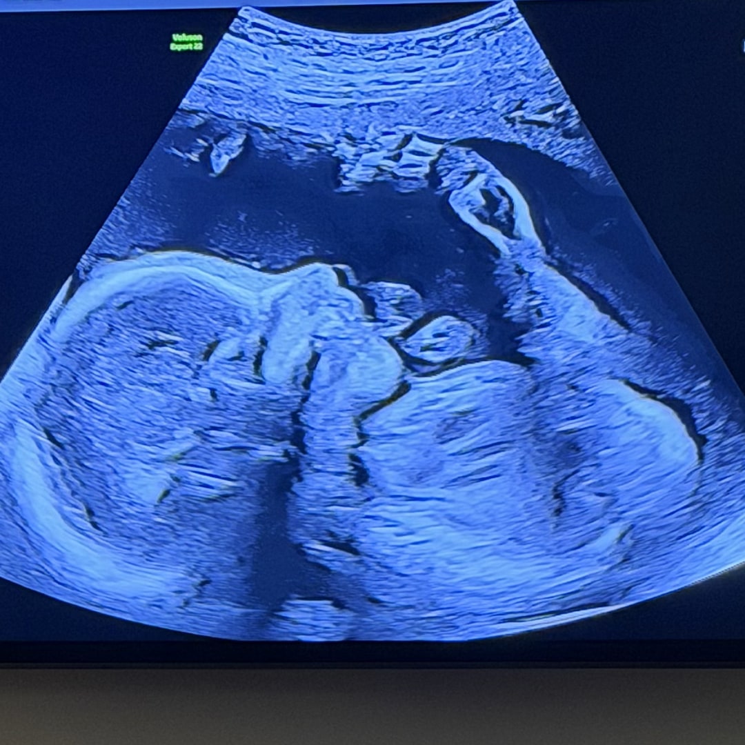 Photo shared by Cornea for their Babylist baby registry.