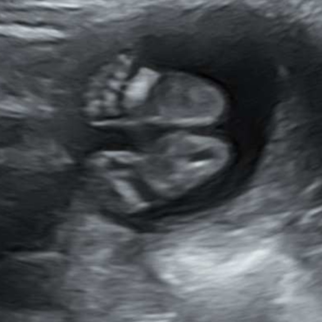 Photo shared by Shanna for their Babylist baby registry.