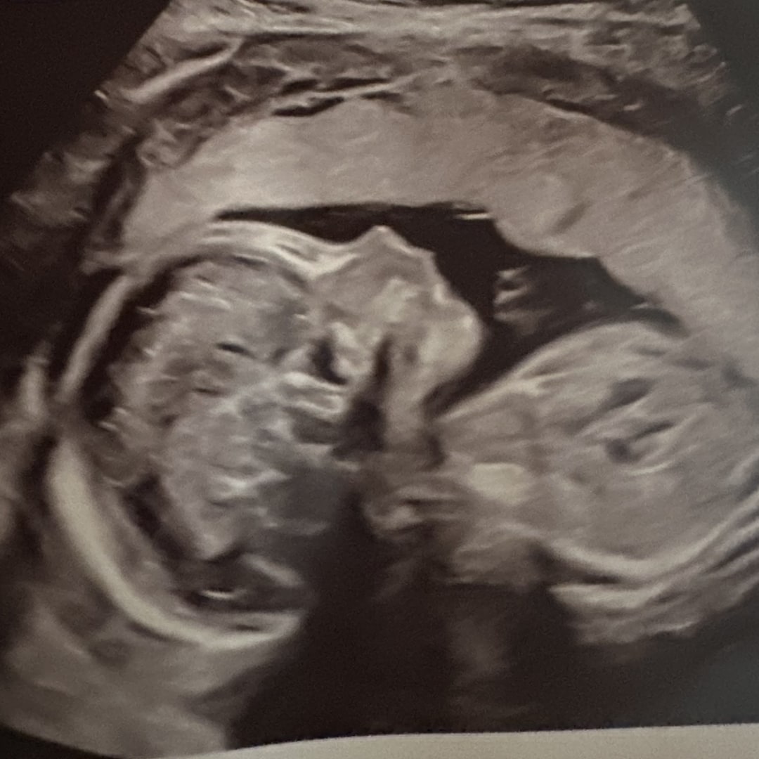 Photo shared by Rosalind for their Babylist baby registry.