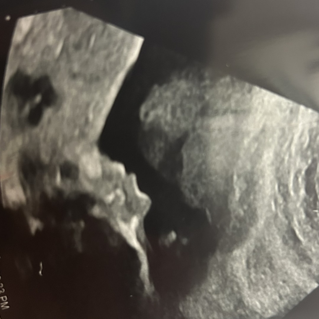 Photo shared by Sayhanna for their Babylist baby registry.