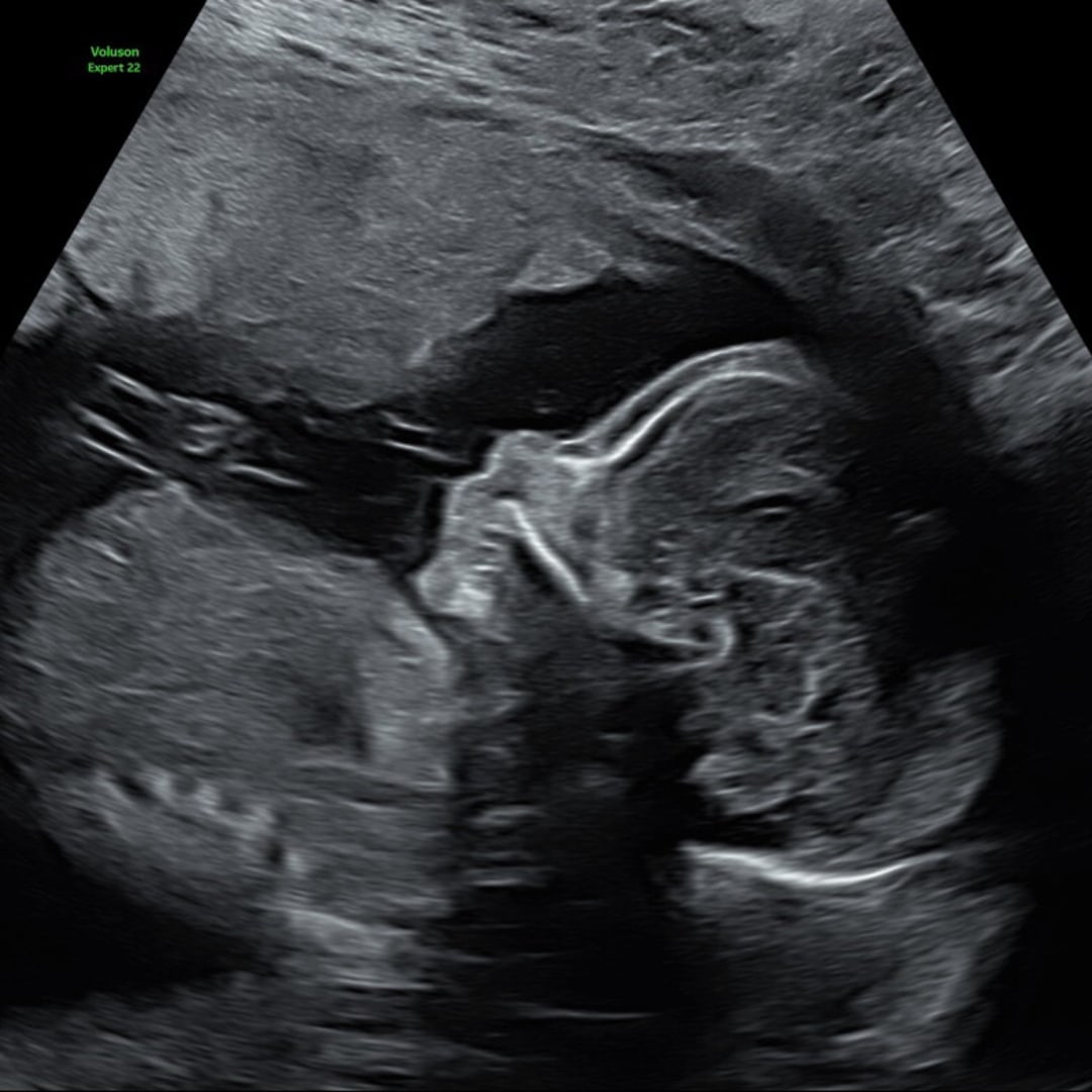 Photo shared by Brenda for their Babylist baby registry.