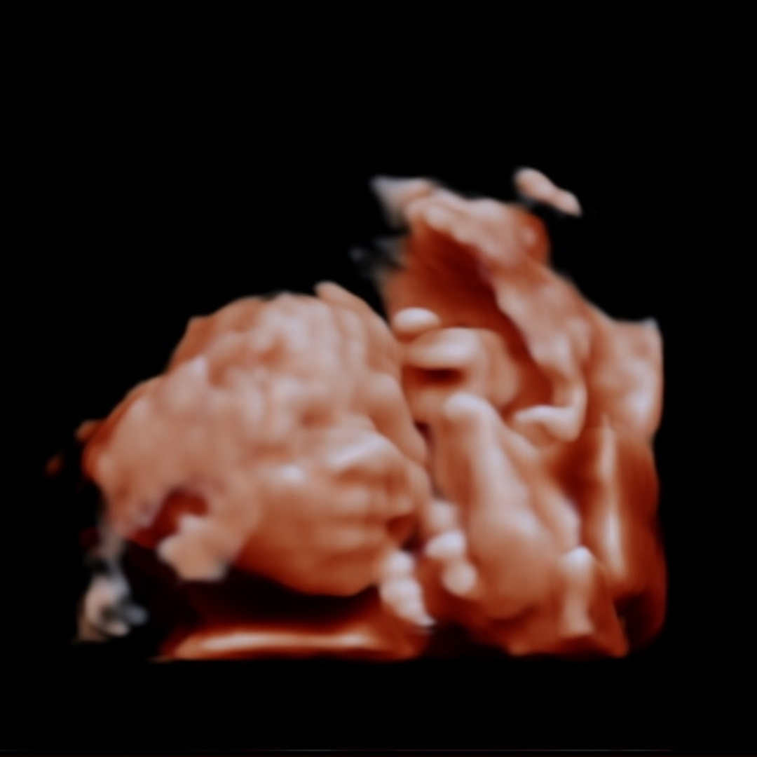 Photo shared by Ashley & Lloyd for their Babylist baby registry.