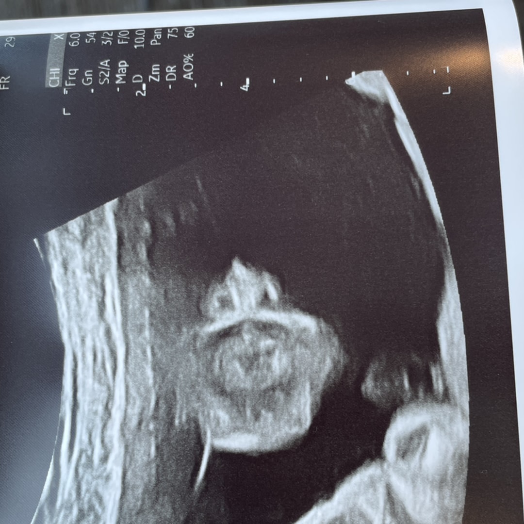 Photo shared by Abigayl for their Babylist baby registry.