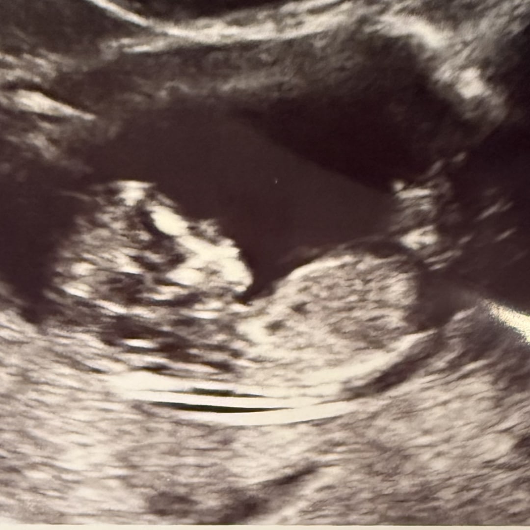 Photo shared by Stephanie for their Babylist baby registry.