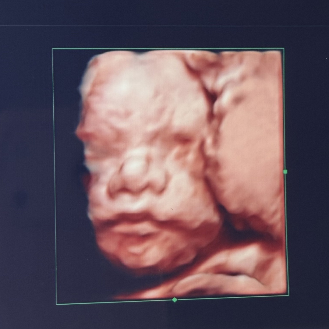 Photo shared by Kelsey for their Babylist baby registry.