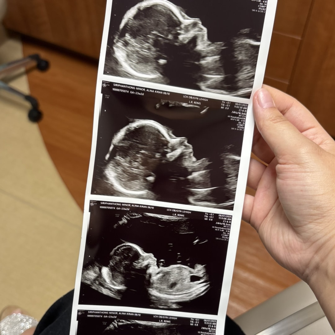 Photo shared by Alina for their Babylist baby registry.