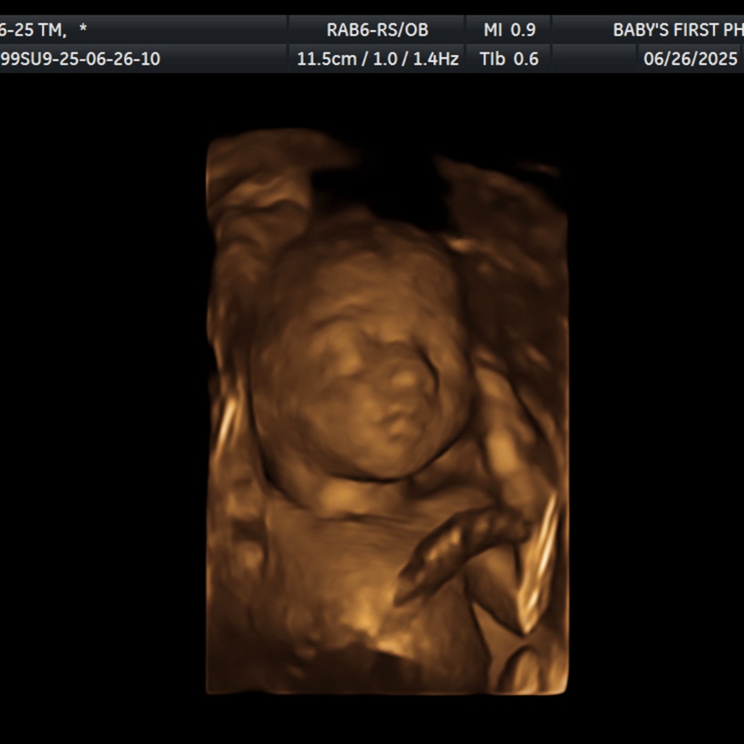 Photo shared by Tierah for their Babylist baby registry.