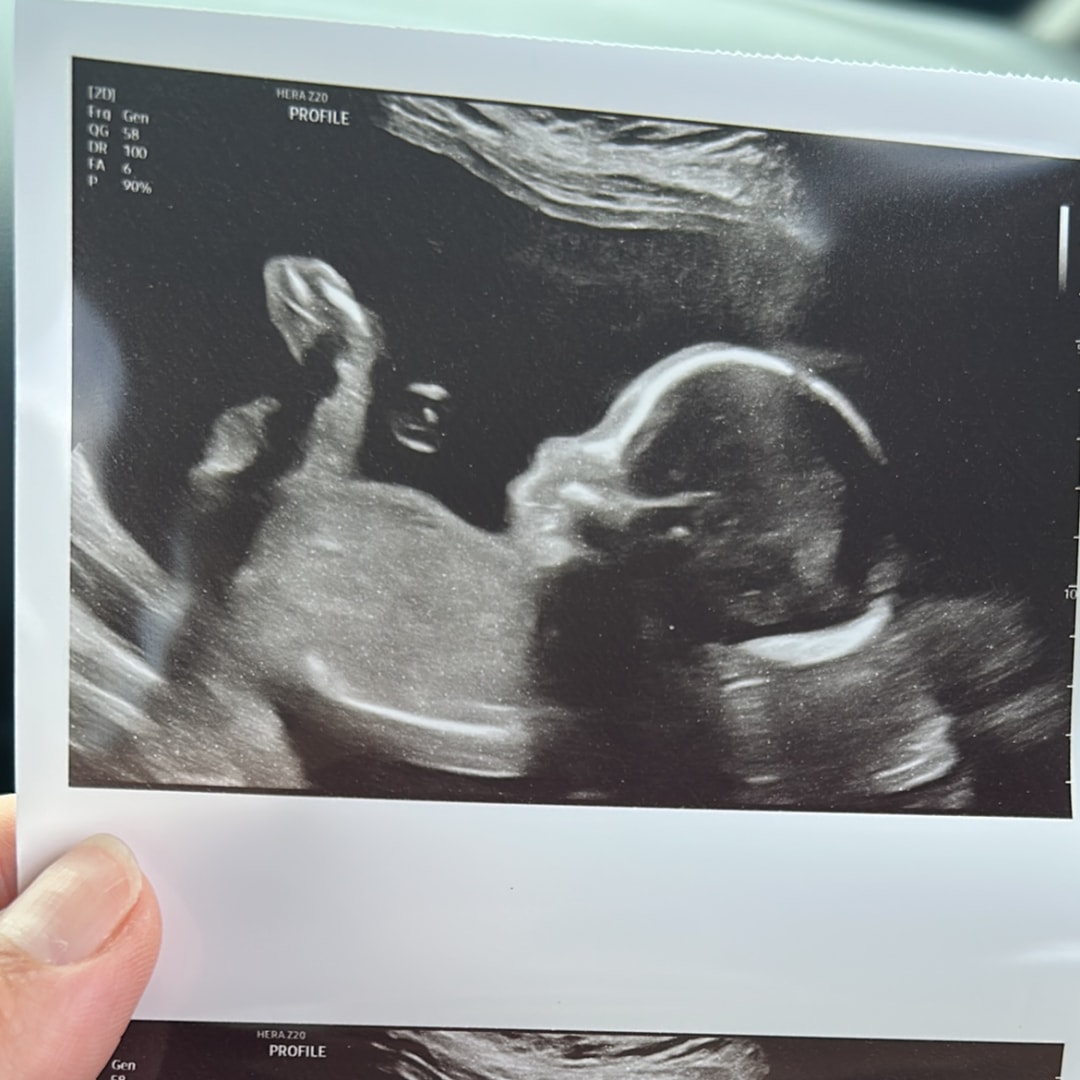 Photo shared by Andreina for their Babylist baby registry.