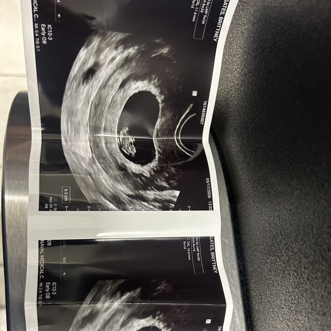 Photo shared by Brittney for their Babylist baby registry.