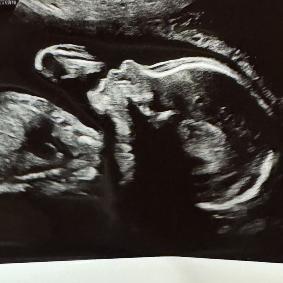 Photo shared by Madie for their Babylist baby registry.