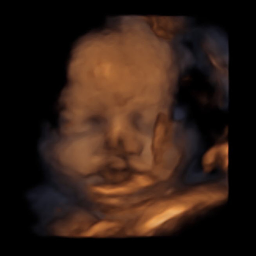 Photo shared by Lizbeth for their Babylist baby registry.