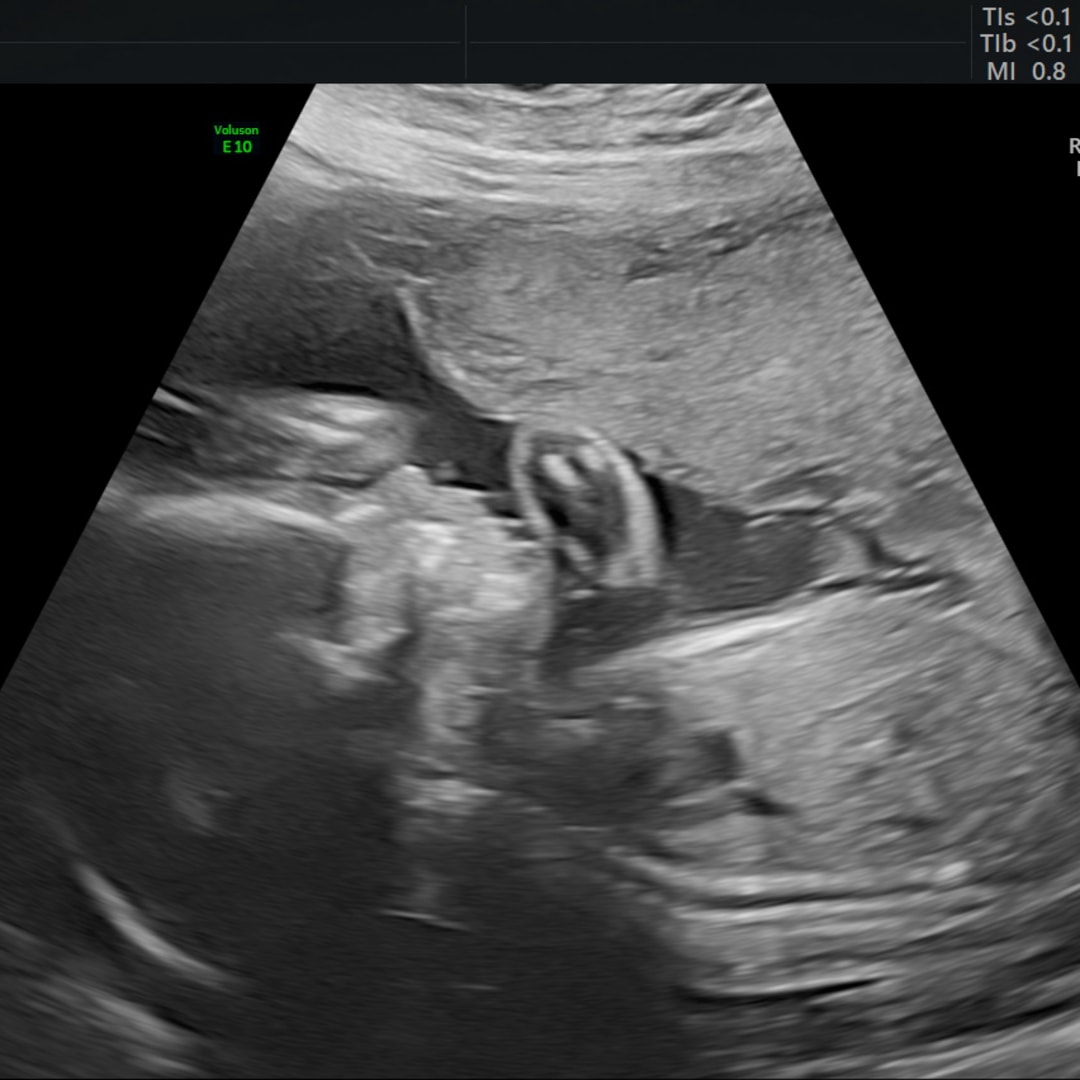 Photo shared by Katie for their Babylist baby registry.