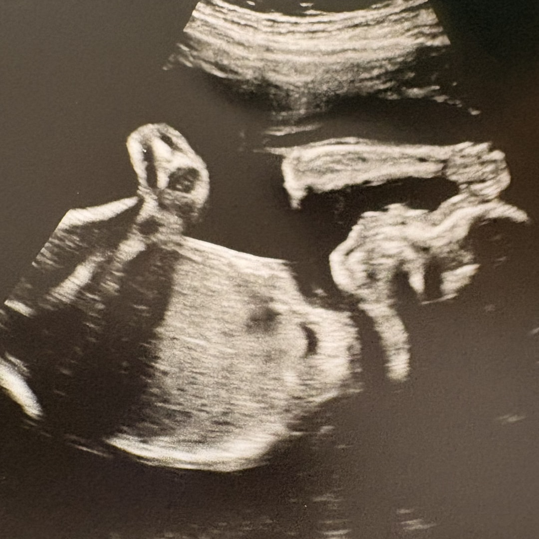 Photo shared by Amaretta for their Babylist baby registry.