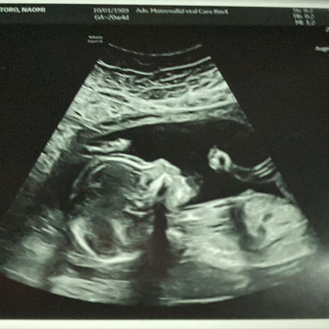 Photo shared by Naomi for their Babylist baby registry.