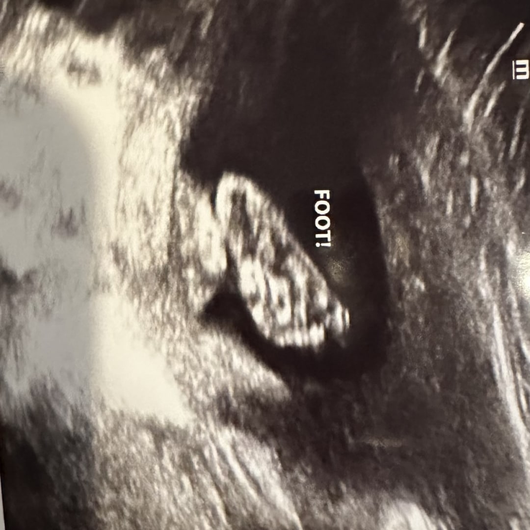 Photo shared by Shanelle for their Babylist baby registry.