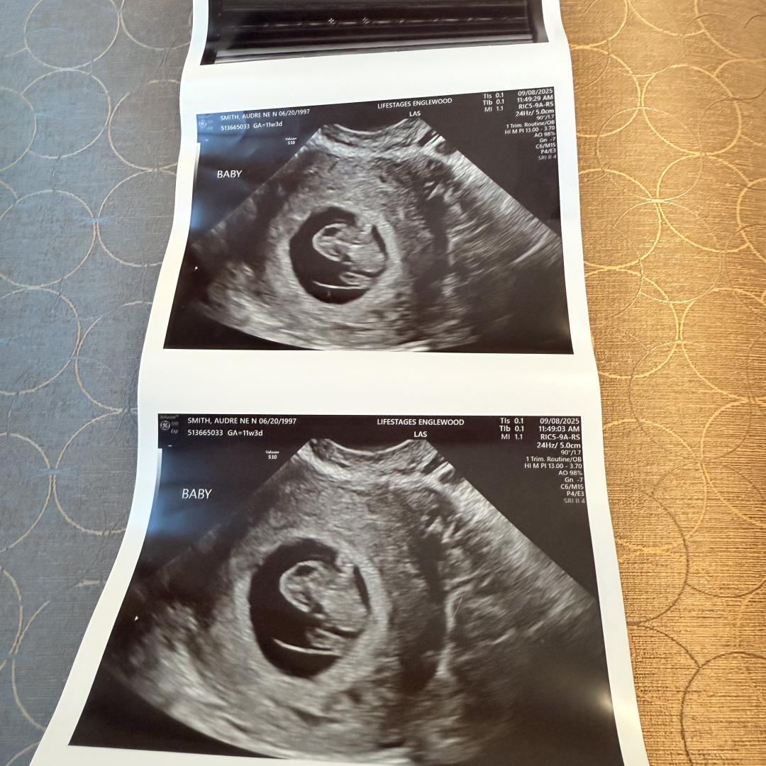 Photo shared by AudreNe for their Babylist baby registry.