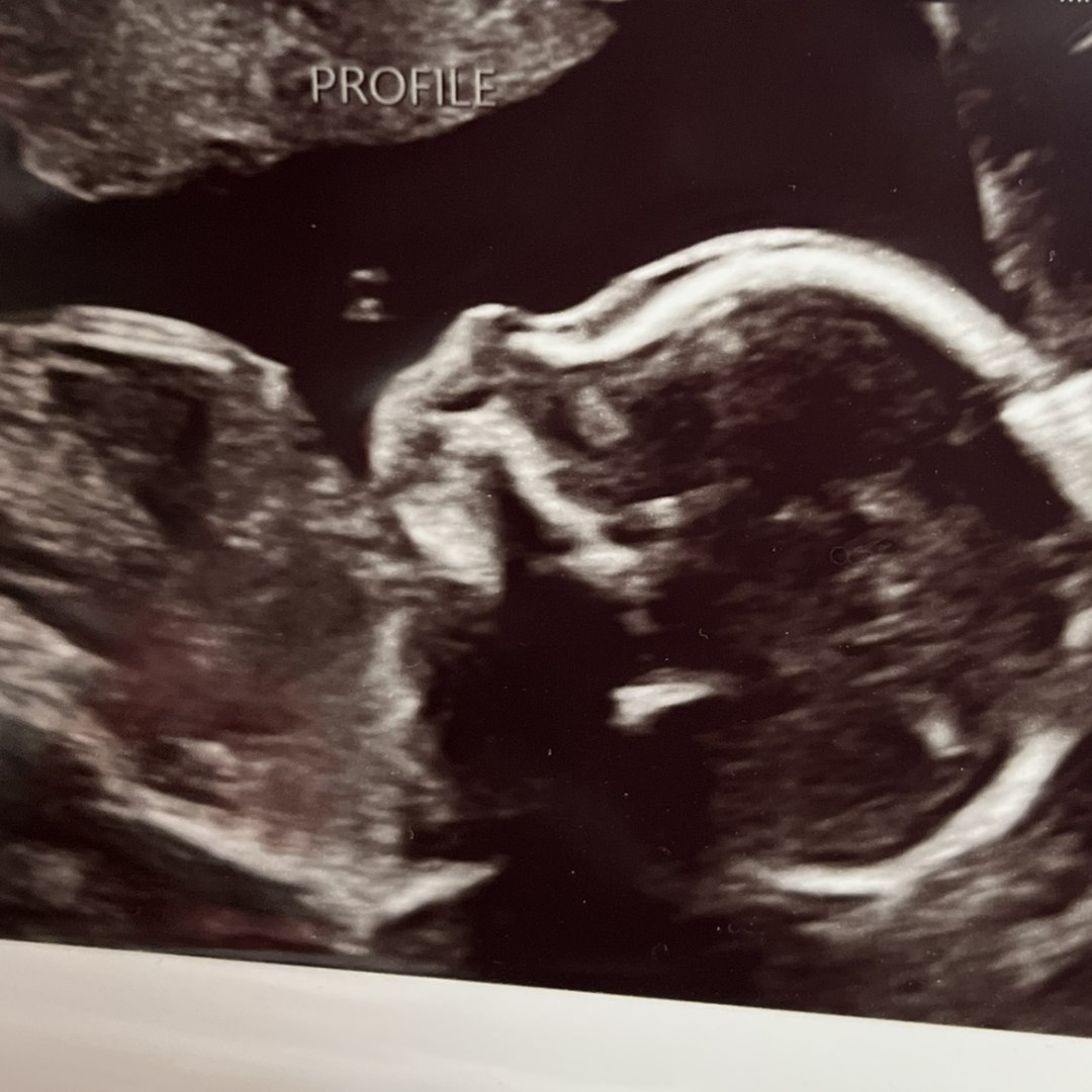 Photo shared by Ashley for their Babylist baby registry.