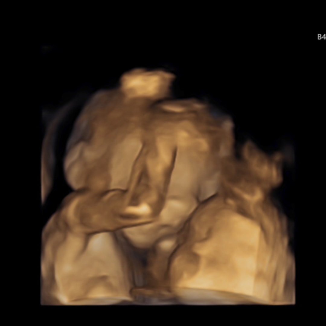 Photo shared by Kristen for their Babylist baby registry.