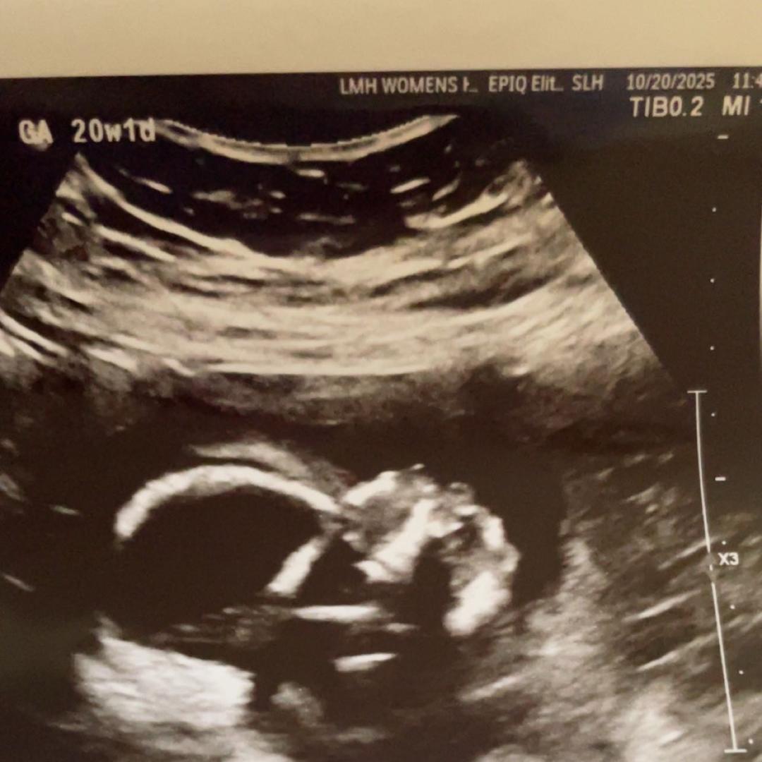 Photo shared by Layla for their Babylist baby registry.