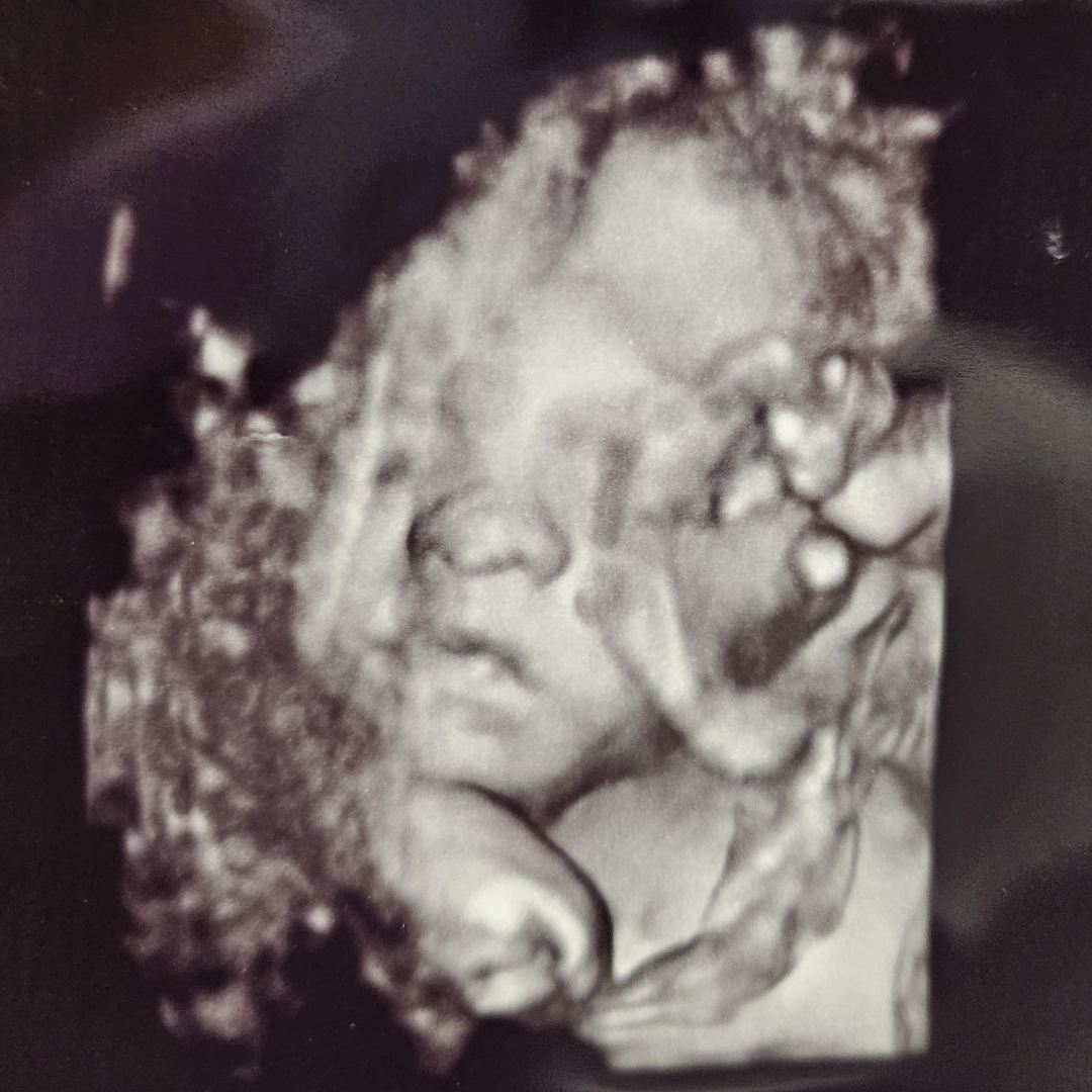Photo shared by Morgan for their Babylist baby registry.