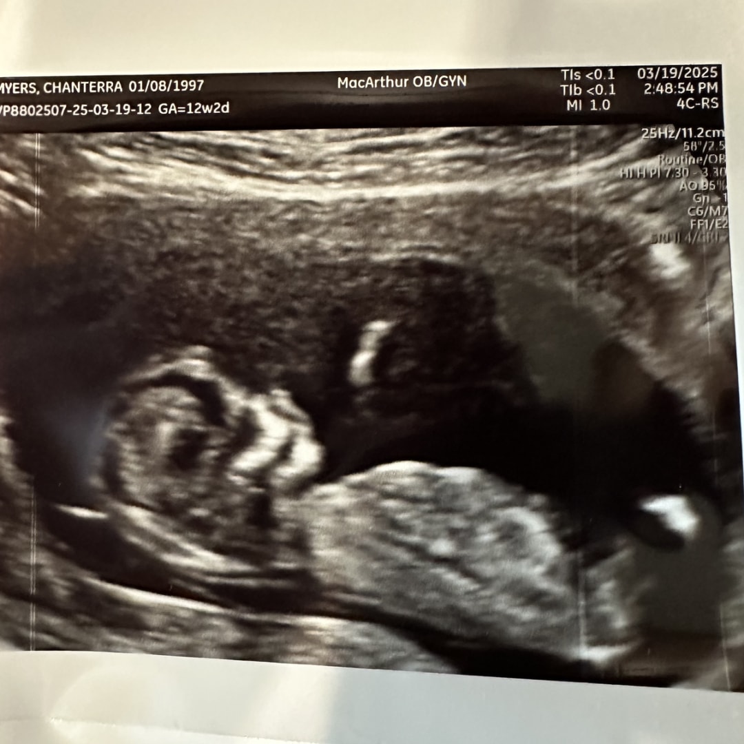 Photo shared by Chanterra for their Babylist baby registry.