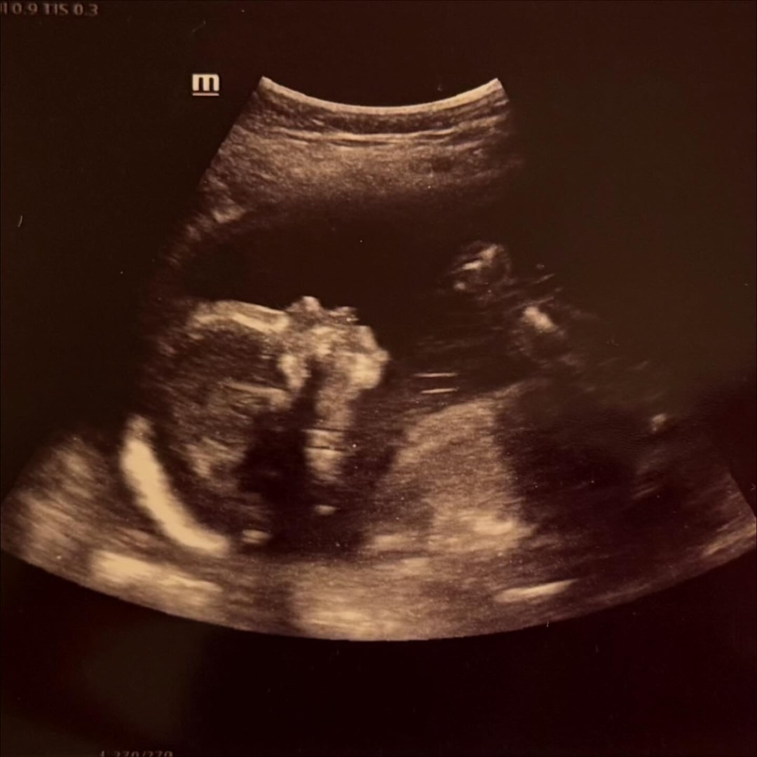 Photo shared by Abigail for their Babylist baby registry.