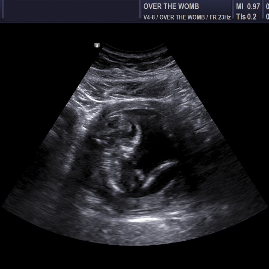 Photo shared by Brenna for their Babylist baby registry.