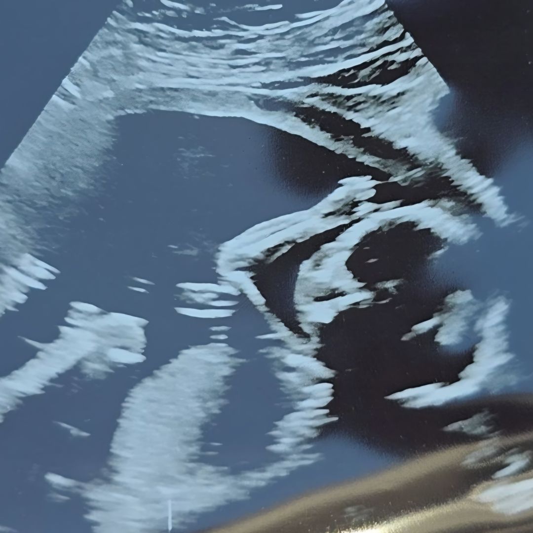 Photo shared by Samantha for their Babylist baby registry.