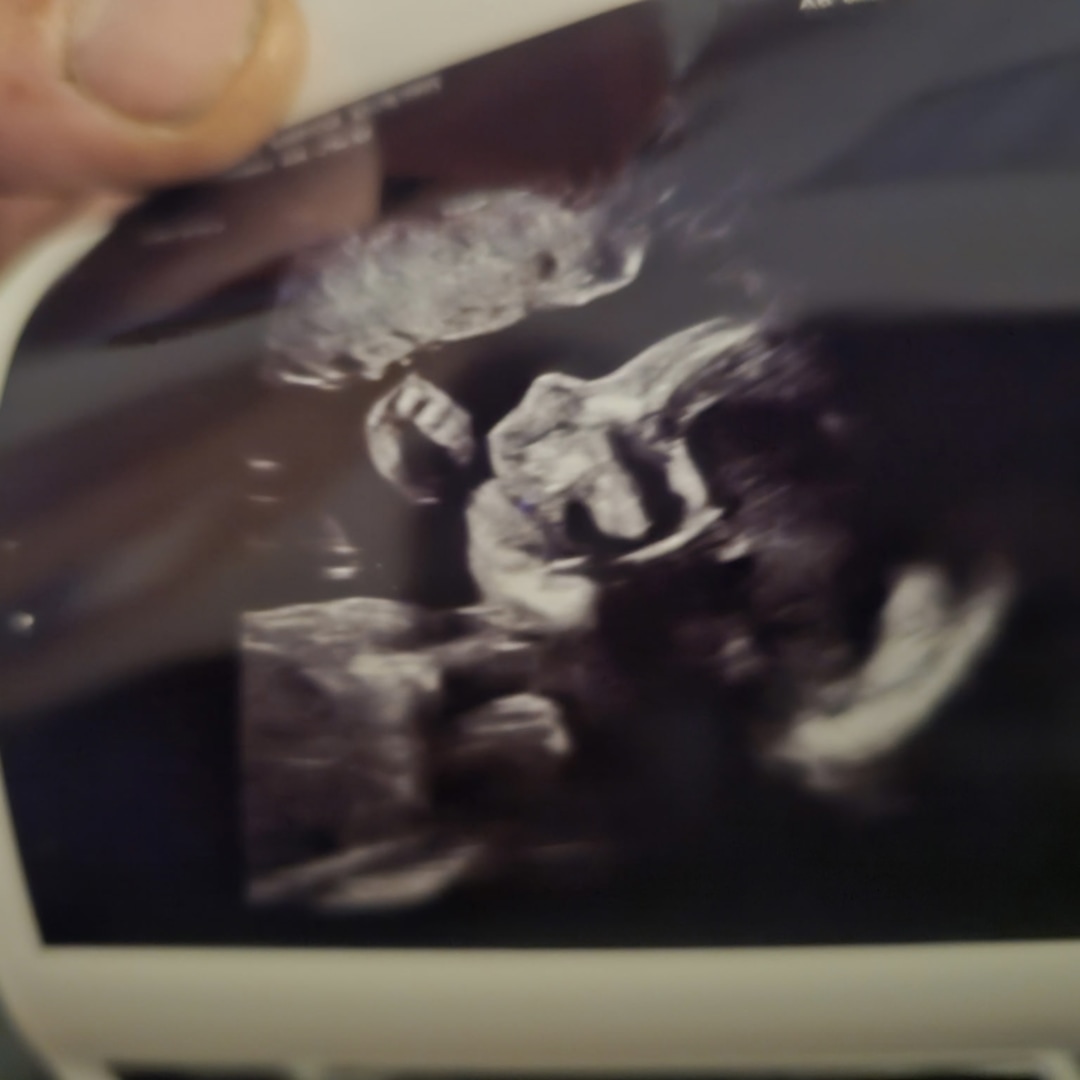 Photo shared by Marissa for their Babylist baby registry.