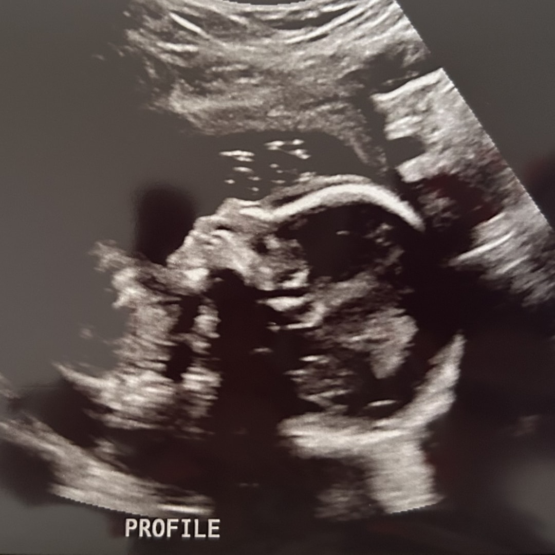 Photo shared by Ann for their Babylist baby registry.