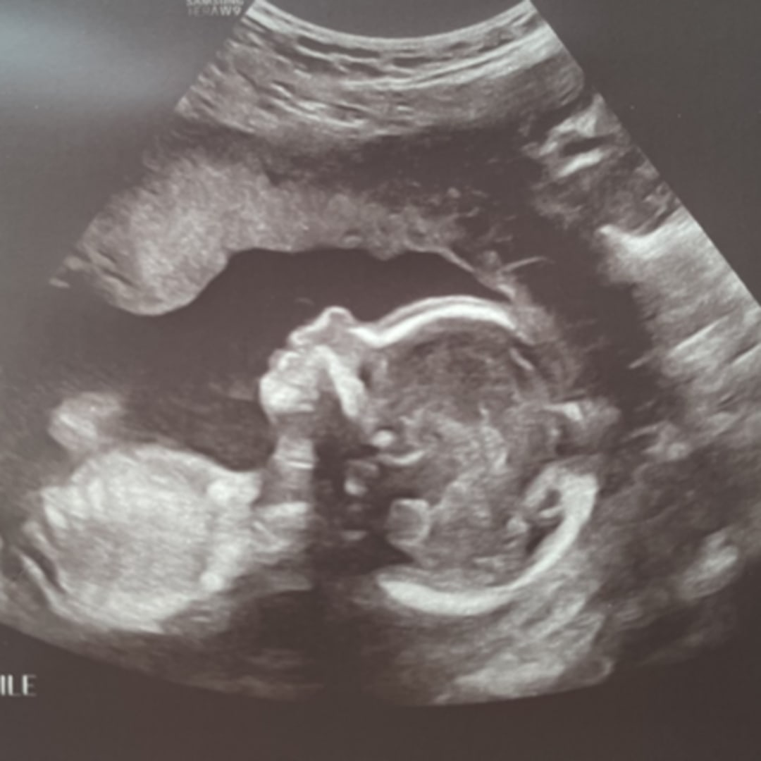 Photo shared by Kelcey for their Babylist baby registry.