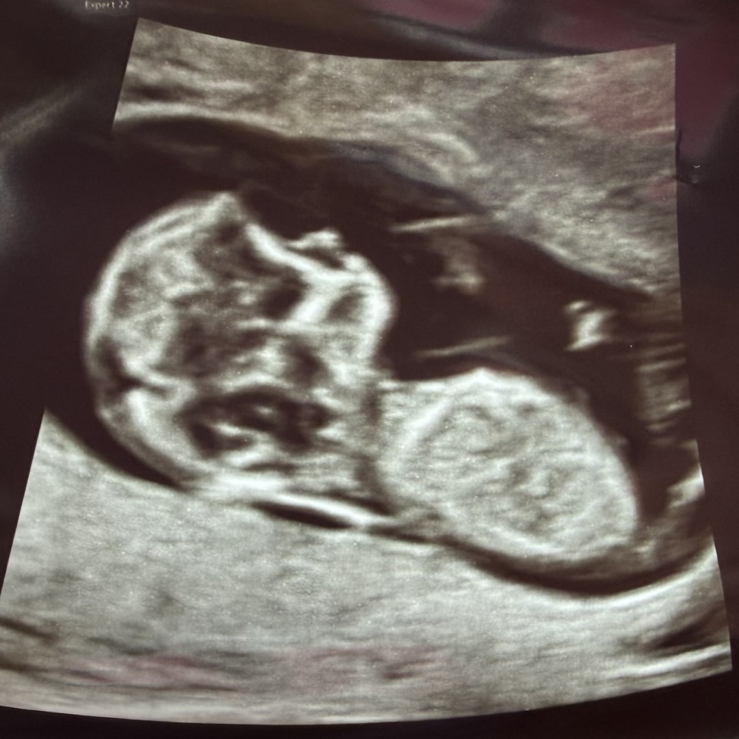 Photo shared by Danielle for their Babylist baby registry.